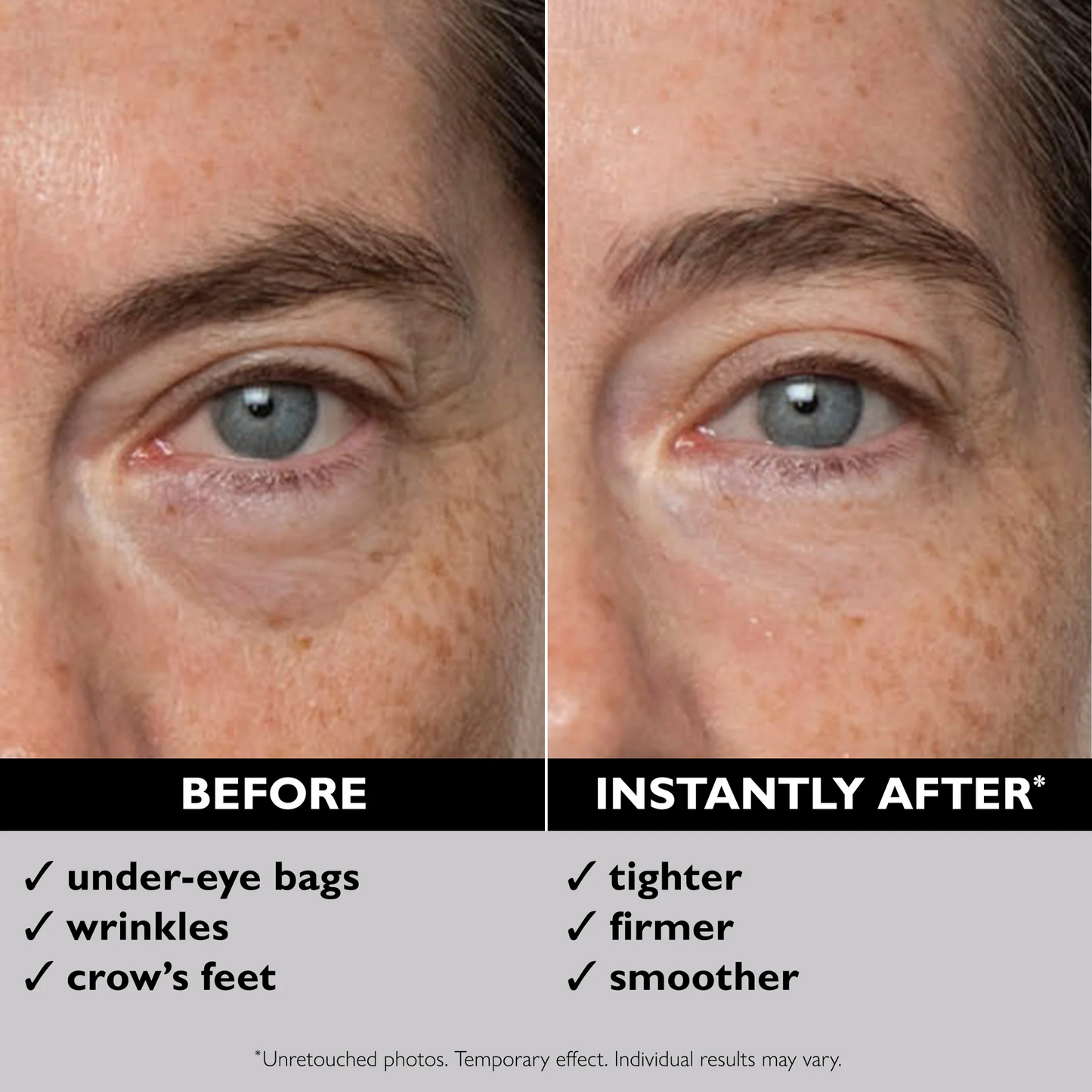 Instant FIRMx Eye Temporary Eye Tightener